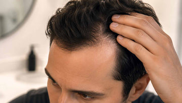 Lelaki mengangkat rambutnya untuk memeriksa garis rambut yang semakin berundur.