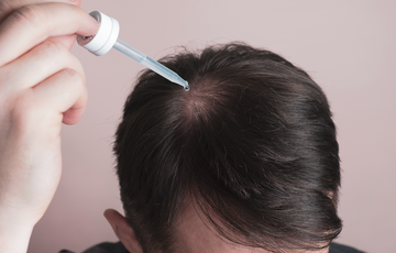 Rawatan rambut cecair disapu pada kulit kepala di bahagian ubun-ubun dengan penitis.