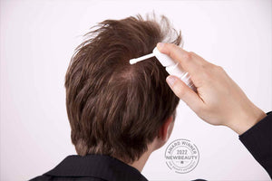 Rawatan rambut sapuan digunakan pada kulit kepala di bahagian ubun-ubun dengan aplikator semburan.