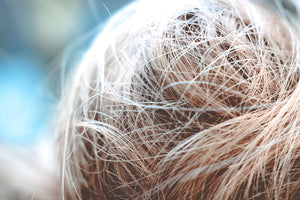 Effective Minoxidil Foam for Men